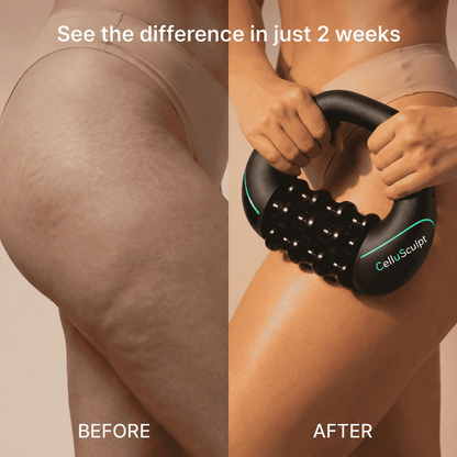 CelluSculpt